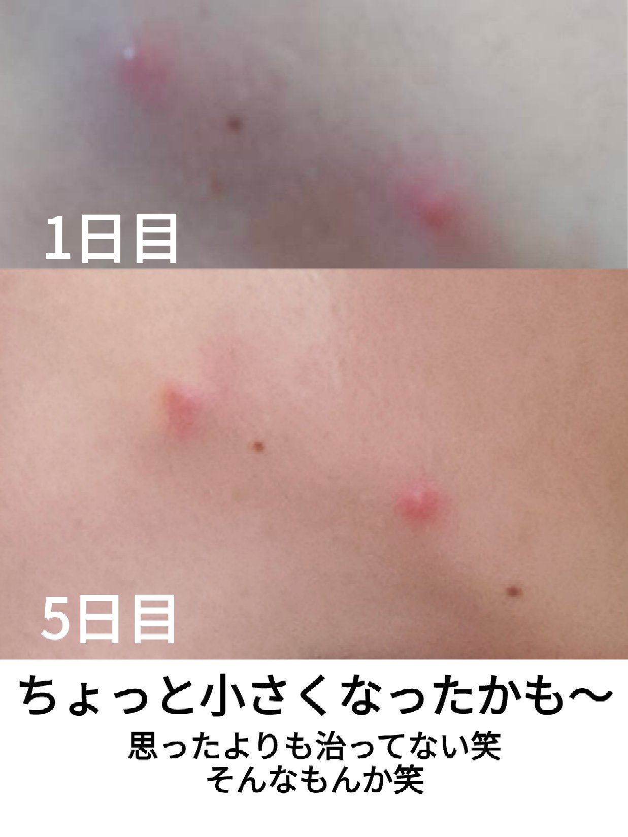 白潤 薬用美白化粧水/肌ラボ/化粧水を使ったクチコミ（2枚目）