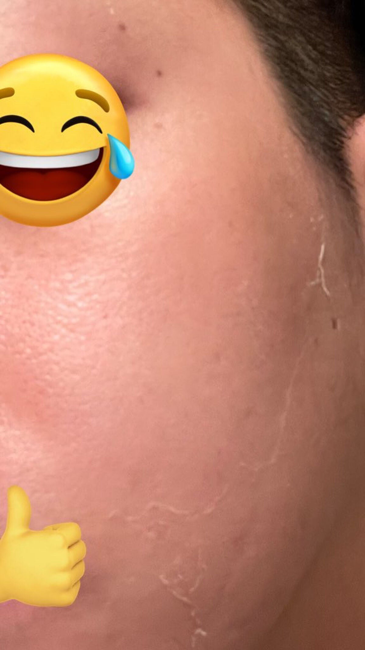 ダーマスキンピーリング/BQCELL/その他キットセットを使ったクチコミ(3枚目)