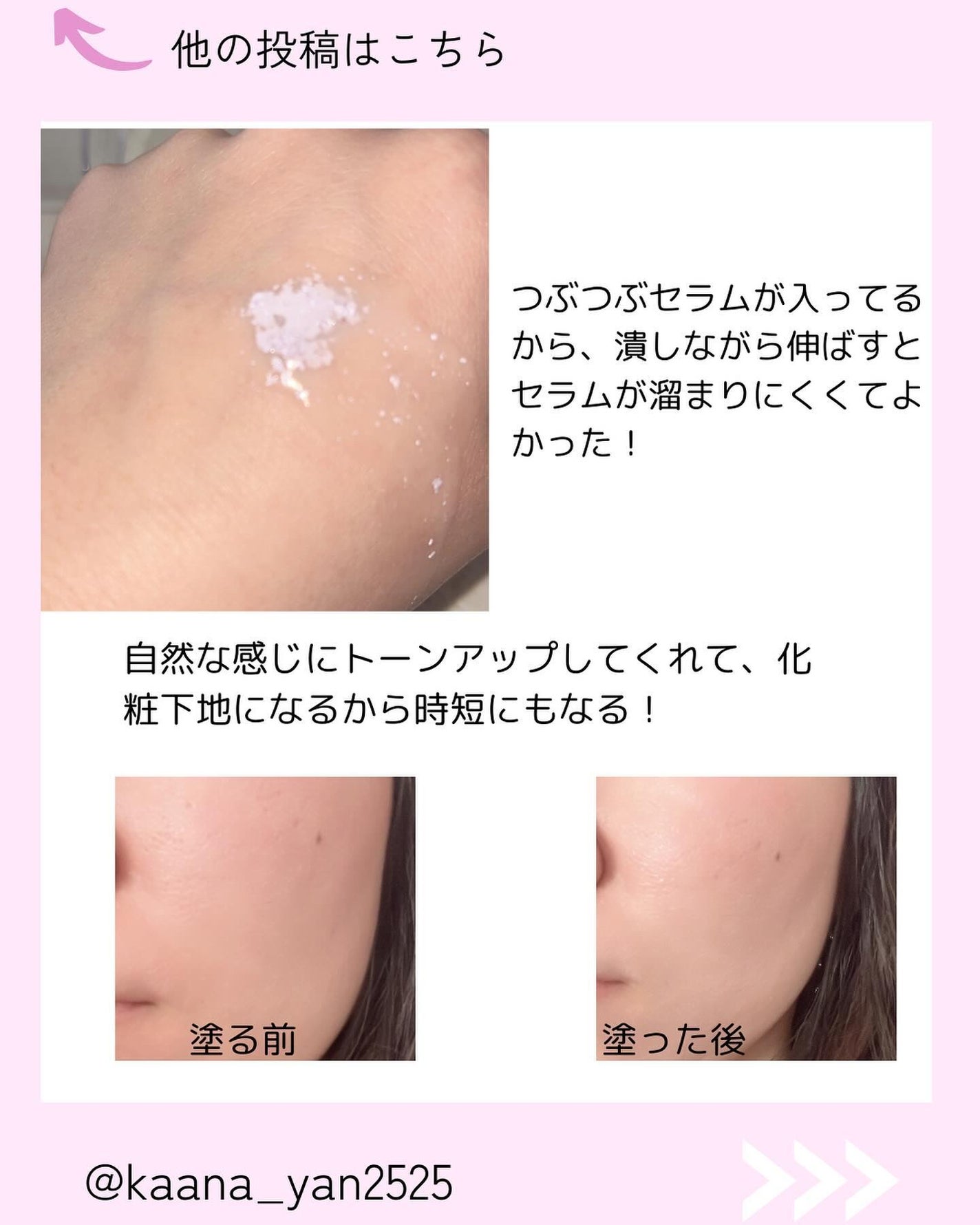 Kana on LIPS 「だんだん明るくなる日焼け♡/いつも投稿見てくれてありがとう🙏🙏..」(4枚目)