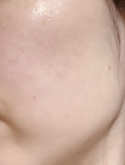 ハトムギ化粧水(ナチュリエ スキンコンディショナー R )/ナチュリエ/化粧水を使ったクチコミ(4枚目)