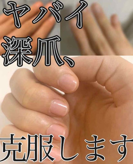 キューティクルオイル/キャンディ ブロッサム/ネイルオイル・トリートメントを使ったクチコミ(1枚目)