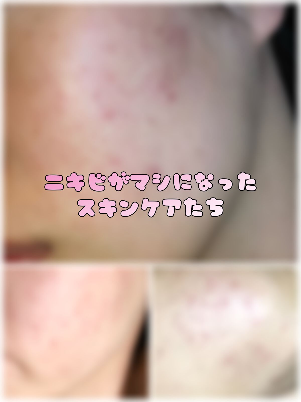 グーダルドクダミHCモイスチャークリームセット/goodal/スキンケアキットを使ったクチコミ（1枚目）