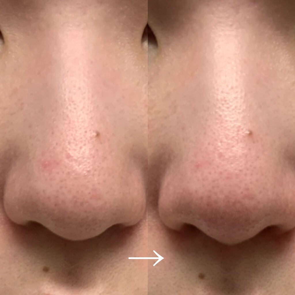 ポアゼロクリアジェル/BRTC/ピーリングを使ったクチコミ(4枚目)