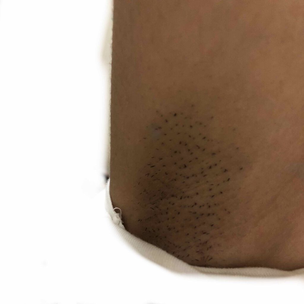 fresh_rouge_hofq on LIPS 「助けてくださーい!この脇の毛ポツポツが治らないし黒い!😭#はじ..」(2枚目)