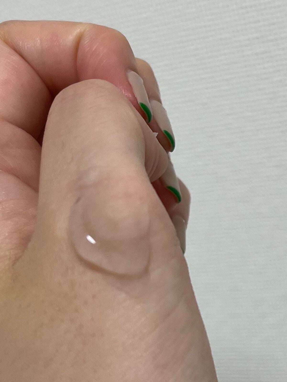 XILOCNARE/TENSHI/オールインワン化粧品を使ったクチコミ(3枚目)