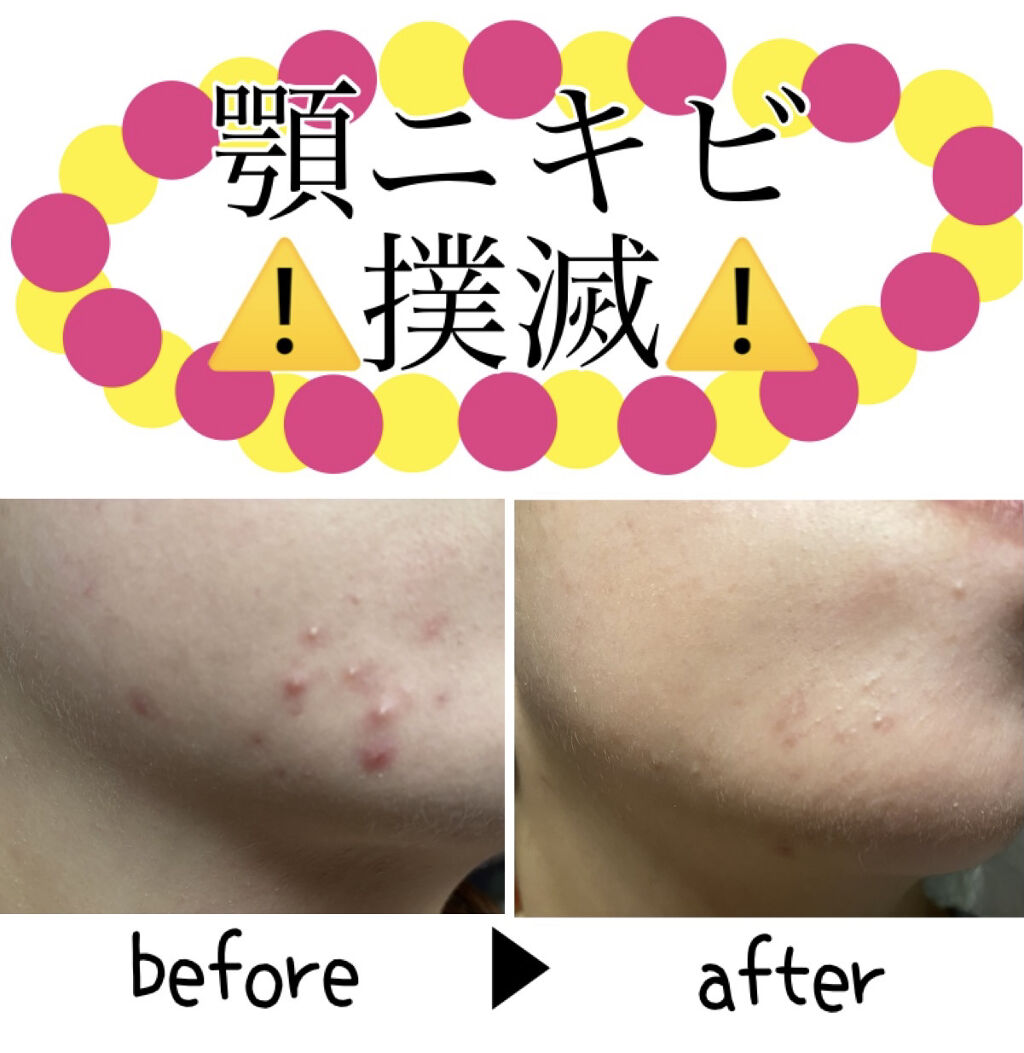 スーパーリンクルクリームVA/KISO/フェイスクリームを使ったクチコミ（1枚目）