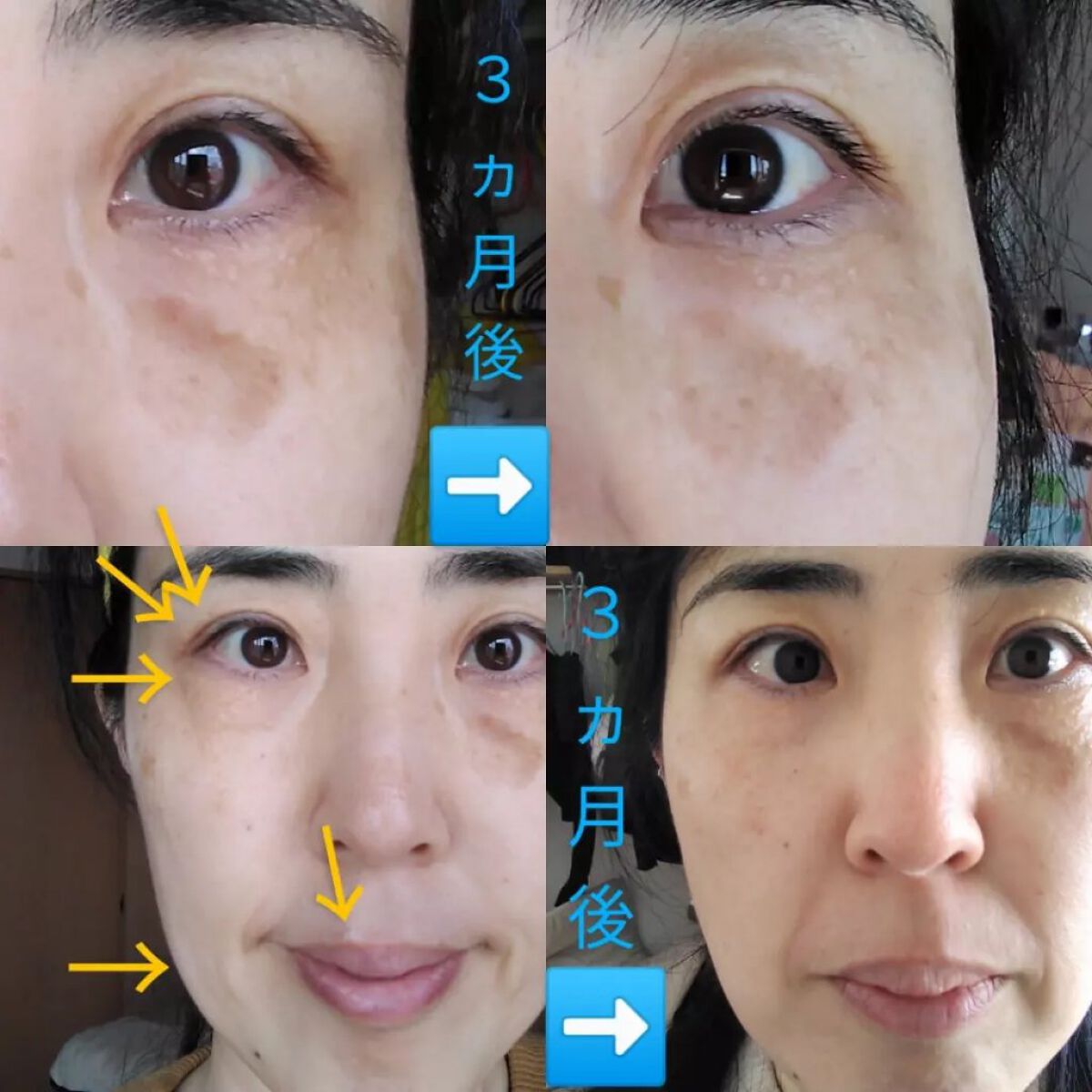 Cエッセンス/EBiS化粧品/美容液を使ったクチコミ(2枚目)