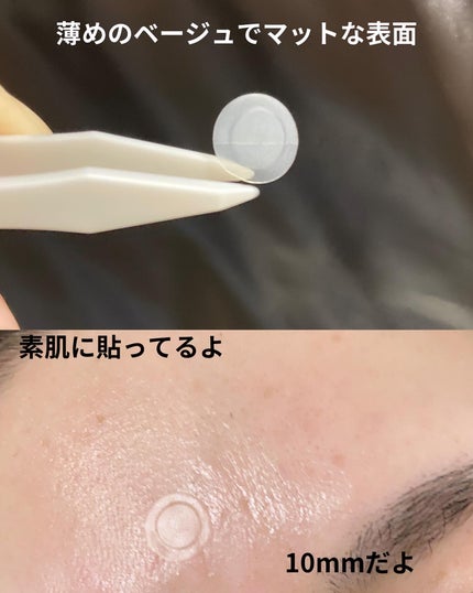 ビューティー スポットパッチ/イージーダムビューティー/にきびパッチを使ったクチコミ(4枚目)