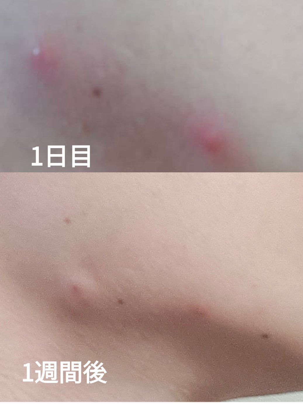 白潤 薬用美白化粧水/肌ラボ/化粧水を使ったクチコミ（2枚目）