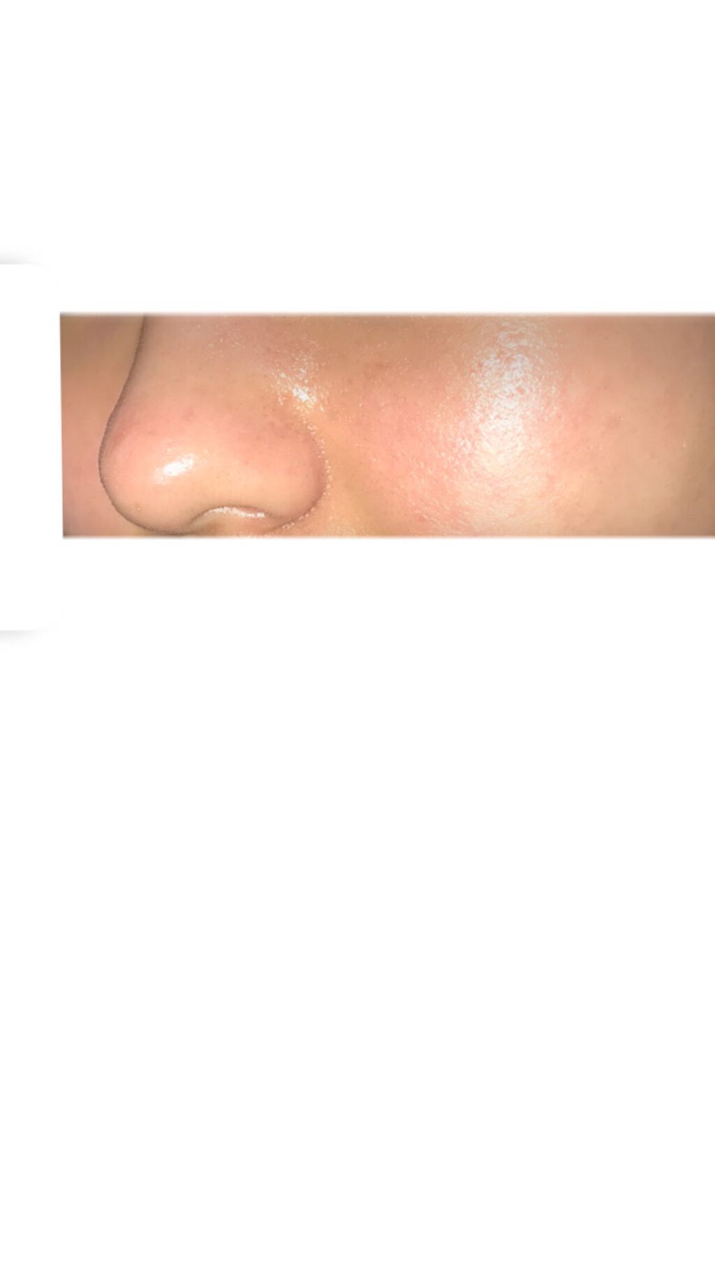 ノブ Ａ アクネソープ/NOV/洗顔石鹸を使ったクチコミ（3枚目）