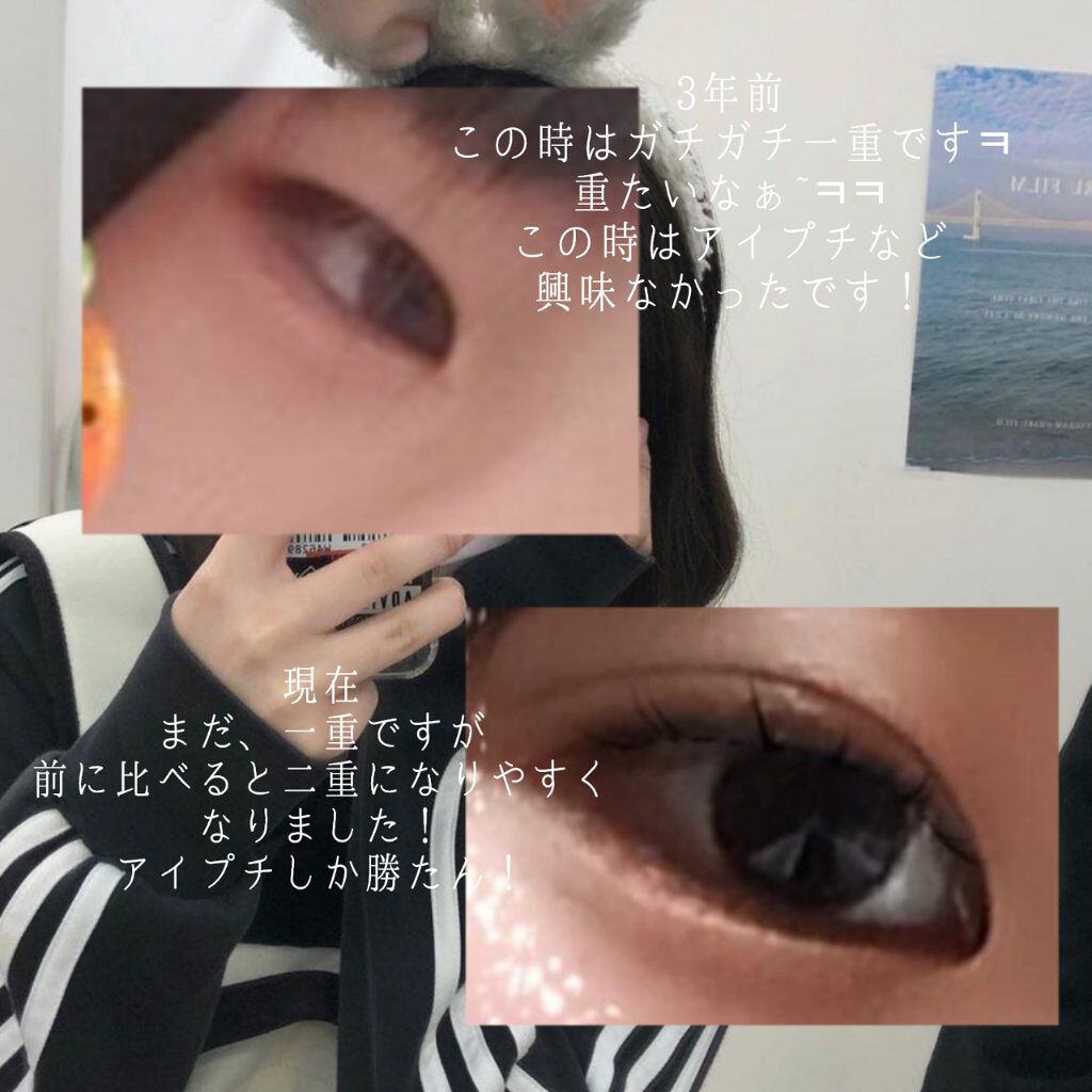 アイビューティー フィクサー WP/アストレア ヴィルゴ/二重まぶた用アイテムを使ったクチコミ（2枚目）