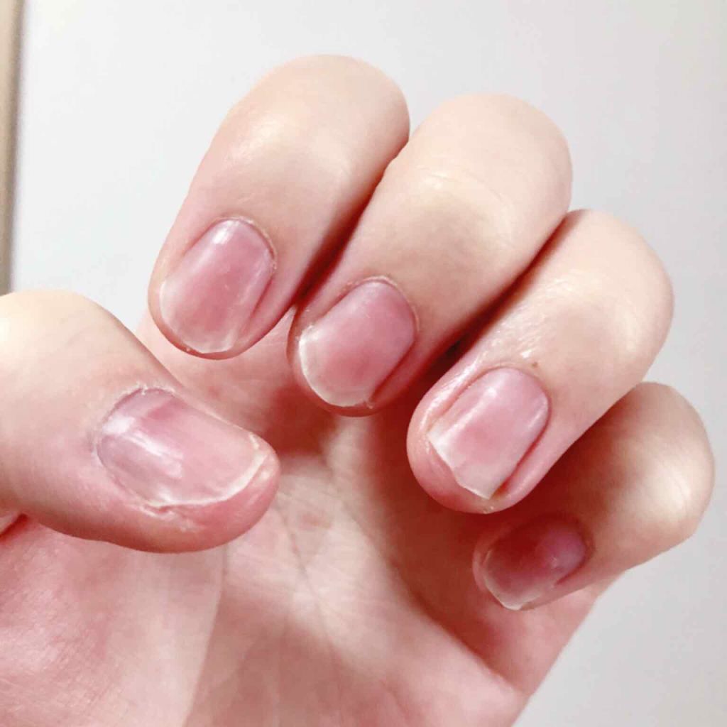 ディープセラム/Dr.Nail/ネイルオイル・トリートメントを使ったクチコミ（2枚目）