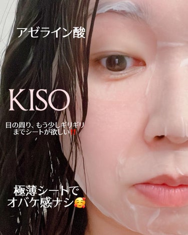 ✩.*˚KISO アゼライン酸 FACE MASK✩.*˚

大好きなKISOのフェイスマスクから、新成分8種が発売されたので、Qoo10メガ割を使ってお得に買えたよ🉐

今までアゼライン酸って、知らな