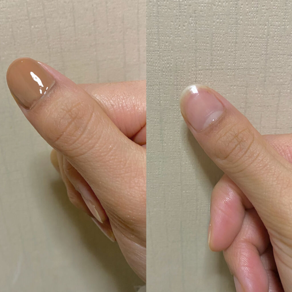 エルファー ネイルキッスC/DAISO/除光液を使ったクチコミ（2枚目）