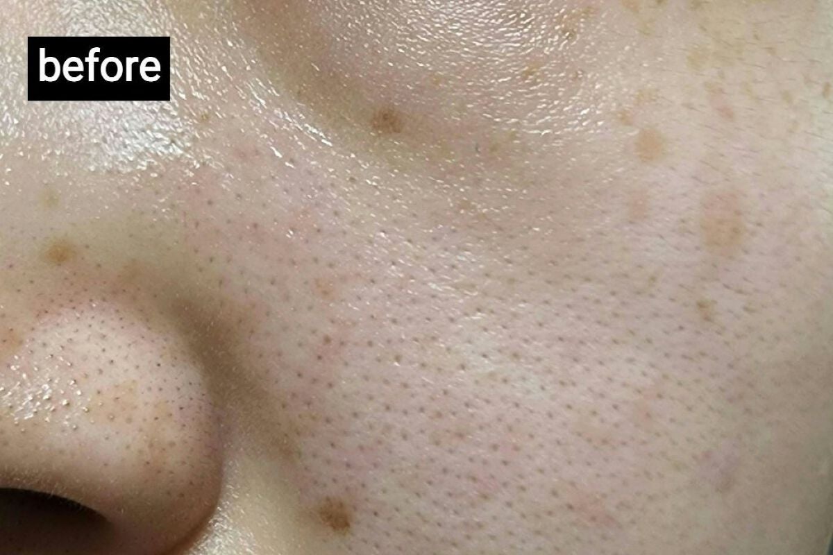 (旧)アンリミテッド ラスティング フルイド/shu uemura/リキッドファンデーションを使ったクチコミ(3枚目)