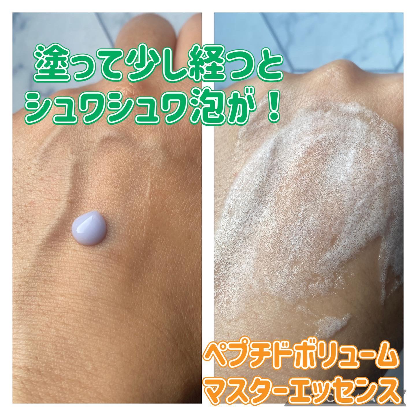 センテラトナー/DR.PEPTI/化粧水を使ったクチコミ（3枚目）