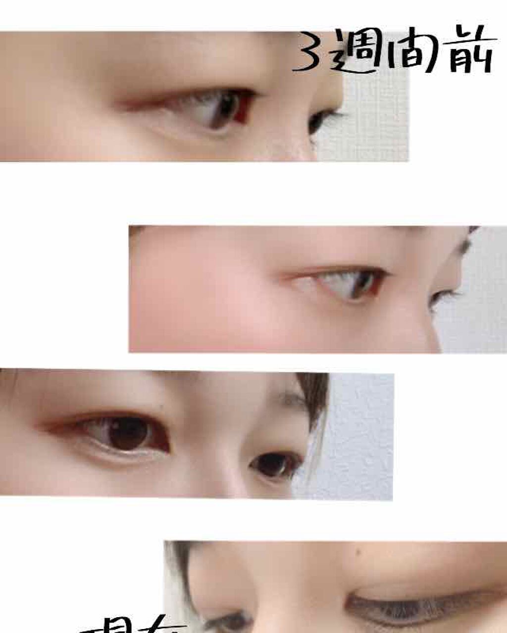 スカルプD ボーテ ピュアフリーアイラッシュセラム/アンファー(スカルプD)/まつげ美容液を使ったクチコミ(4枚目)