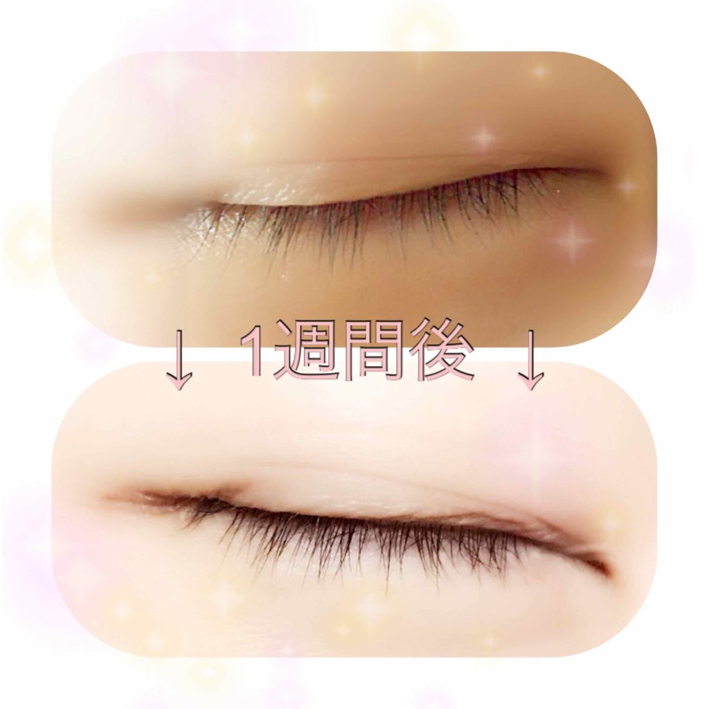 THE まつ毛美容液/UZU BY FLOWFUSHI/まつげ美容液を使ったクチコミ（2枚目）