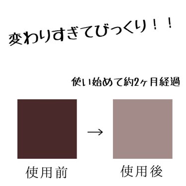 はじめまして！こんにちは！ぱあむと申します！

デリケートなお話第２弾失礼します🙇🏻‍♀️💦
苦手な方はここから回れ右でお願いします

✂ーーーーーーーーーーーーーーーーーーーーーーーーーーーーーー✂

今回私が紹介します物は #アンティームホワイトクリーム です！
これはどうしても紹介したかったんですよ､､､
何故かと言いますとバストトップの黒ずみに効果的だったからです！

前回に引き続きお恥ずかしい話なのですが、バストトップの黒ずみも気になってまして…
すごく悩んでたんですよ､､､温泉や旅行の時とか気になるじゃないですか、
もう嫌すぎて嫌すぎて…それと同時にデリケートゾーンの黒ずみも気にしだして…
という感じで誰にも相談できないような悩みばっかりだったんです

そんな悩みを撃退出来たのがこのクリーム！
デリケートゾーン用美容クリームですよ、めっちゃ期待しちゃいますよね(((
口コミでも黒ずみが目立たなくなったなど高評価ばかりだったのでちょっとお高めでしたが購入しました！

お値段は2,860円(100ｇ)でした！

私からしたらかなりお高い😿
でも！それほどの効果はあったので買ったことに関して後悔はしてません！

✂ーーーーーーーーーーーーーーーーーーーーーーーーーーーーーー✂

【感想】

実際使ってみた感想なんですけど、まず2枚目見てくれましたか？
これはこのクリームを使う約2ヶ月前と現在のお乳首様の色です
ibisPaint Xを使ってスポイトで色をとったので信憑性は高いと思います

どうですか？めちゃくちゃ変わってません？？？
2ヶ月でこんなにも効果が出るなんて…思ってなかった、
ある意味裏切られたと言ってもいいもの…

そしてvioの方はと言うと、少し変わったかな…？という程度でした
(元々はこっちの黒ずみの方を無くしたくて使ってたんですけどね)
でも徐々に薄くなってると思うのでこれからも使っていこうと思ってます！

香りは柑橘系(？)で少し強めの香りでした
でも少ししたら消えるのでそんなに気にならないかな…？という感じです

✂ーーーーーーーーーーーーーーーーーーーーーーーーーーーーーー✂

バストトップもvioも黒ずみの原因は乾燥
なので私はお風呂上がりまず初めにやることはこのクリームをバストトップとvioの部分に塗ること！
しっかりと馴染ませて保湿します
保湿がちゃんと出来ていれば黒ずみも徐々に薄くなっていくので保湿を怠らないことも大事です！



私事なんですけど、ありがたいことに彼氏がいまして…最近めちゃくちゃ私の胸を触りたがったり見たがったりするんです…(前はあんまりなかったのに)
やっぱりお乳首様は薄い方が好きなんですかね？？？
でもまあ、これのおかげで彼氏とのスキンシップも多くなったので良かったと思います🙌


最後までご覧いたただきありがとうございました🙏
参考にどうぞ🙇🏻‍♀️
あくまでも個人的な感想ですがどなたかのお役に立てれば幸いです！

【追記】
バストトップの色の差なんですけど、全体的というより先の部分の色が劇的に変わったということですので周りの部分とはまだ戦ってます😢
でも少しは薄くなったかな…？という感じにはなりました！

#アンティームホワイトクリーム
#デリケートゾーン #vioケア #バストトップ #黒ずみの画像 その1