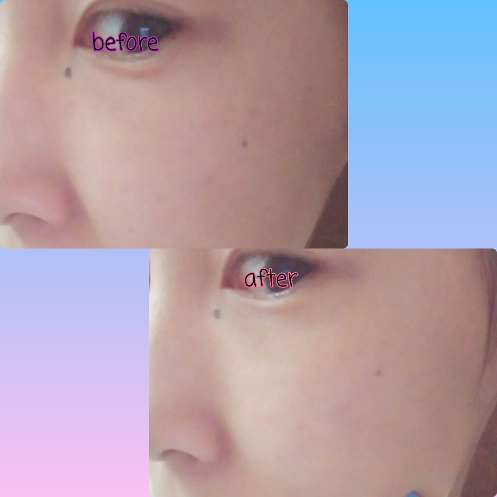 シリカ原液100/シリカスタイル/美容液を使ったクチコミ(4枚目)