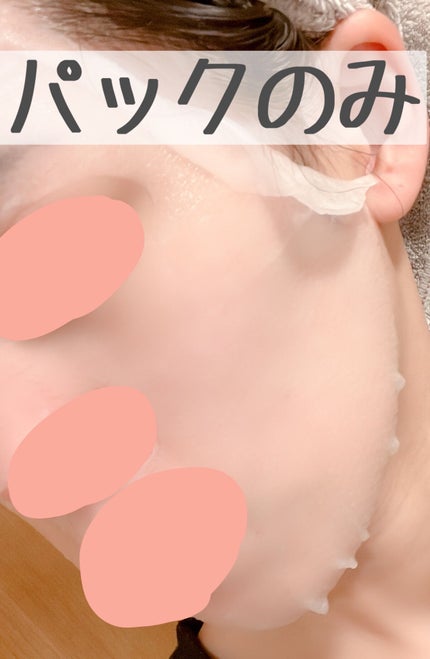 ããããBOMBãã¹ã¯/ã¯ãªã¢ã¿ãŒã³/ã·ãŒããã¹ã¯ã»ããã¯ã䜿ã£ãã¯ãã³ãïŒ5æç®ïŒ