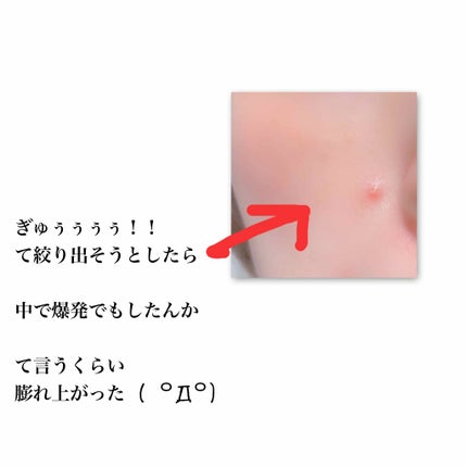 【旧品】マシュマロフィニッシュパウダー/キャンメイク/プレストパウダーを使ったクチコミ(2枚目)