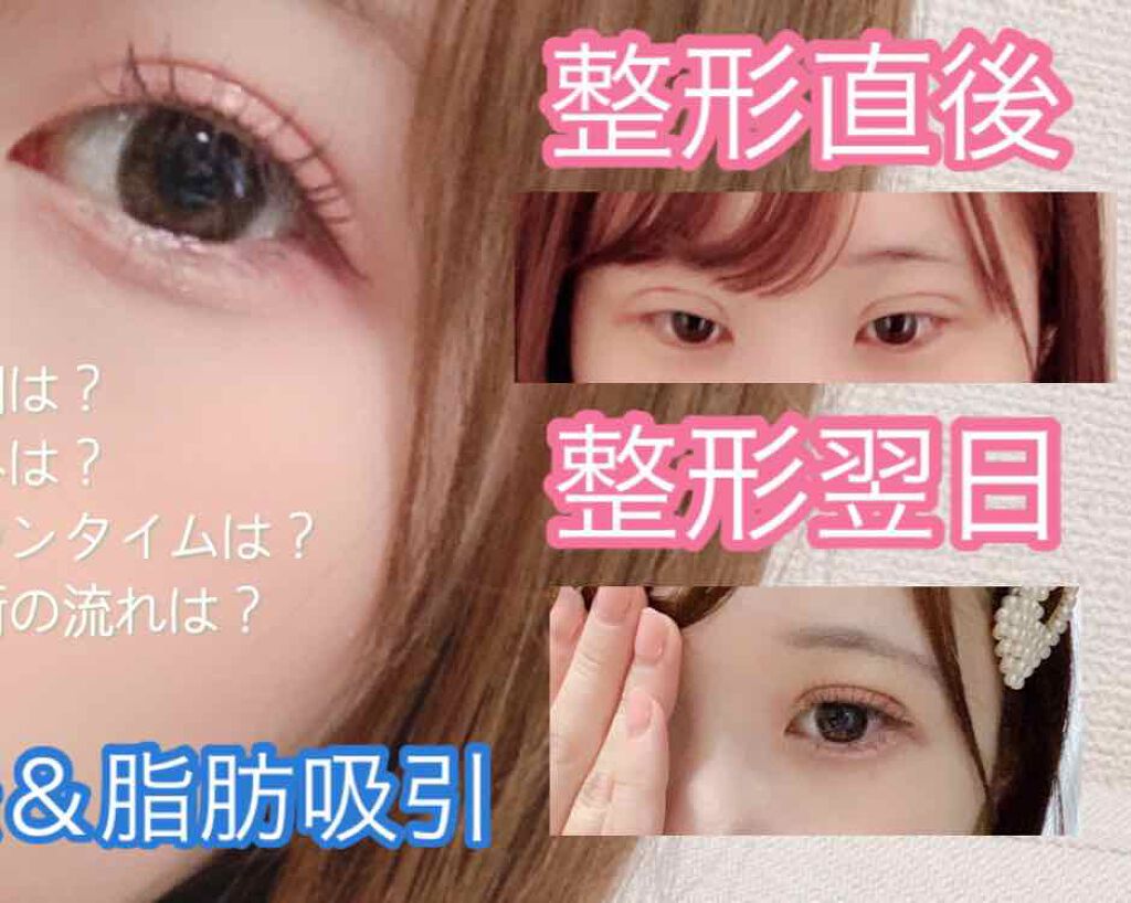 アイビューティー フィクサー WP/アストレア ヴィルゴ/二重まぶた用アイテムを使ったクチコミ（2枚目）