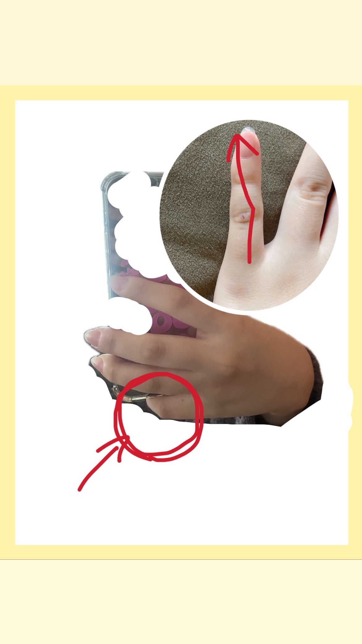 めん。 on LIPS 「そのスマホの持ち方危険⚠️指が曲がっちゃうよ!!😱😱スマホの待..」(2枚目)