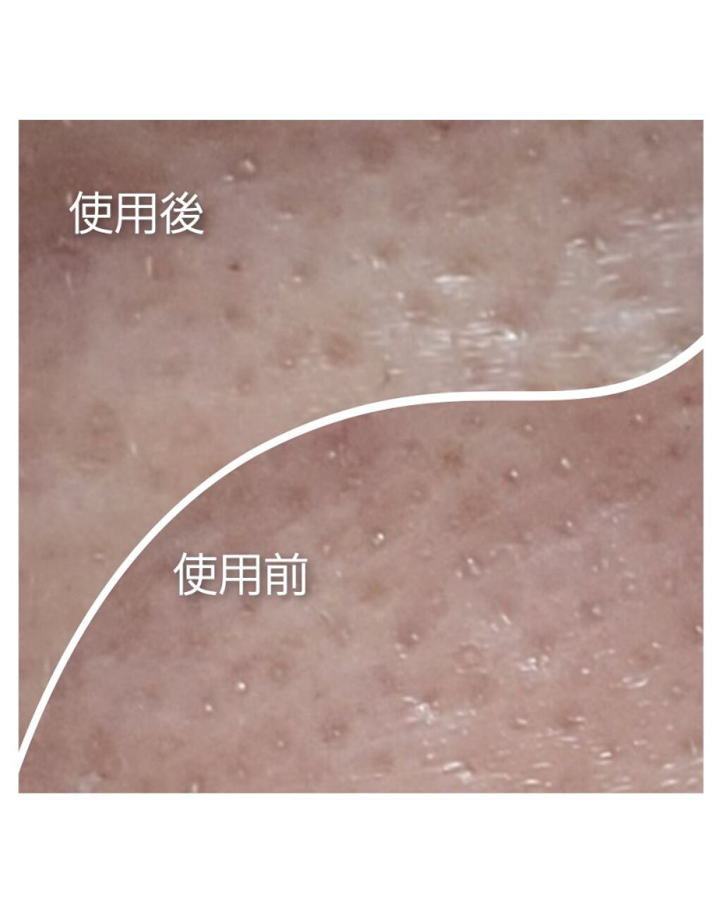 エマルジョンリムーバー　300ml/200ml/水橋保寿堂製薬/その他洗顔料を使ったクチコミ（2枚目）