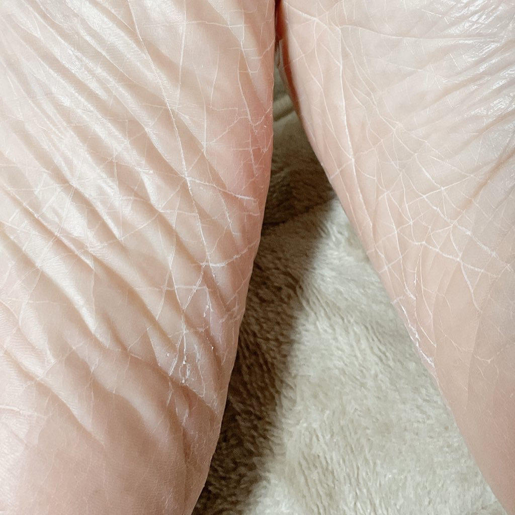 あしやすめ 足裏角質ケアパック/鎌倉ライフ/レッグ・フットケアを使ったクチコミ（3枚目）