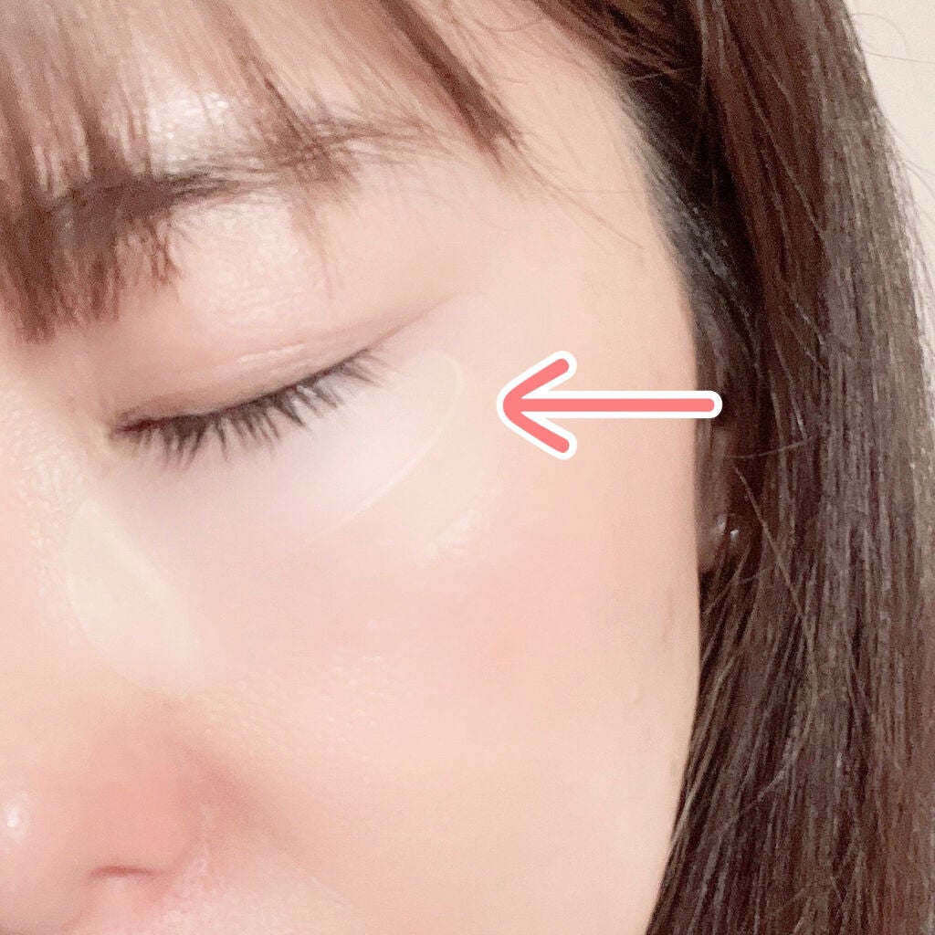 リンクルスポットマスク/クオシア/シートマスク・パックを使ったクチコミ(3枚目)