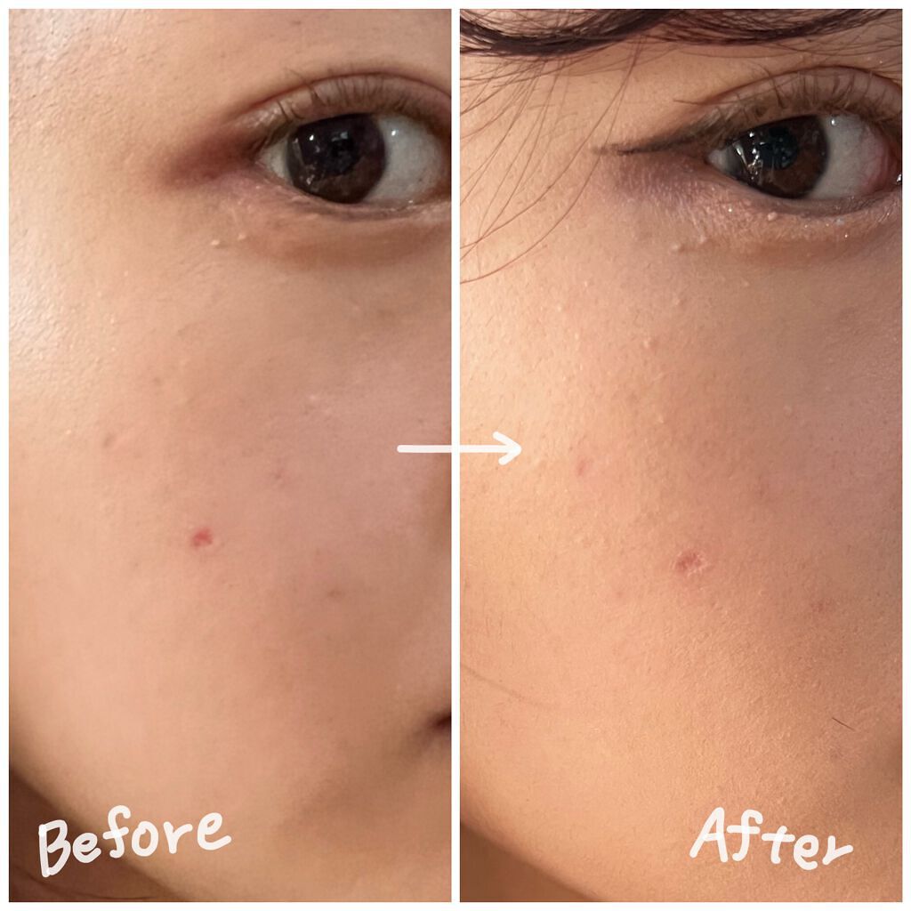 ãªãŒã«ã¢ã¯ãŒãº ãªããã/YVES SAINT LAURENT BEAUTE/ãªããããã¡ã³ããŒã·ã§ã³ã䜿ã£ãã¯ãã³ãïŒ2æç®ïŒ