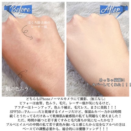 ピンクティーツリーカバークッション/APLIN/クッションファンデーションを使ったクチコミ(5枚目)