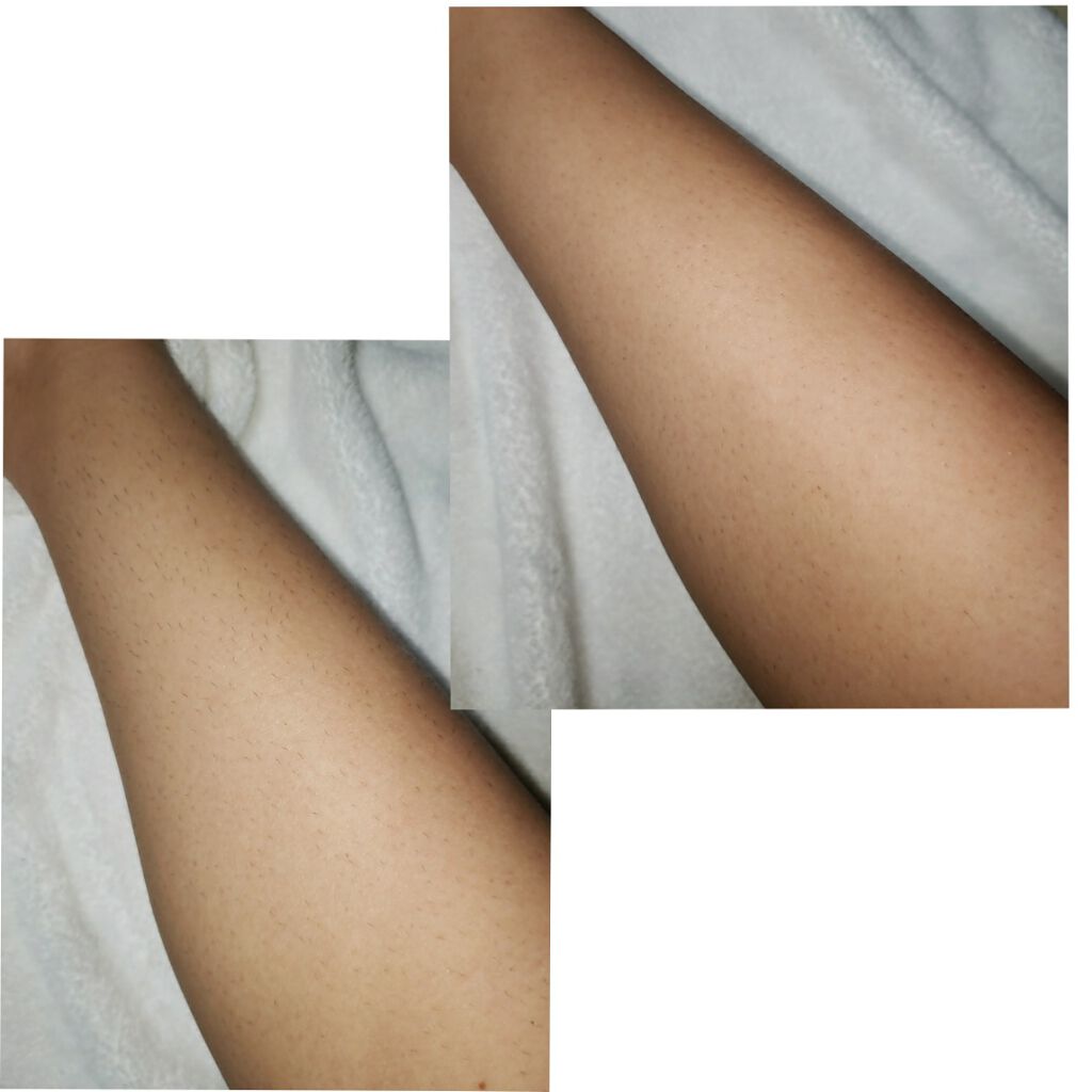 Kmyu(ケミュー)/CONTRIBUTION/除毛クリームを使ったクチコミ(2枚目)