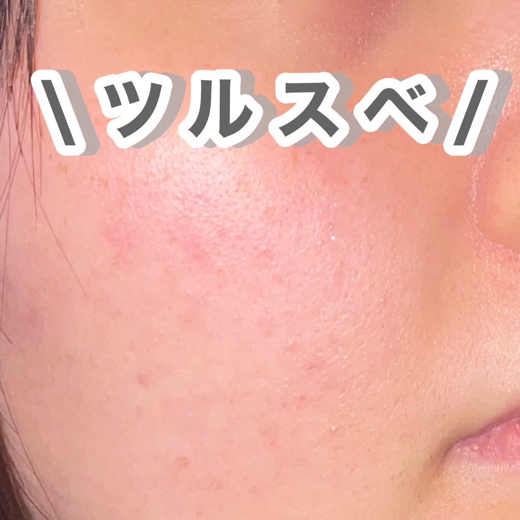 ルルルンピュア エブリーズ/ルルルン/シートマスク・パックを使ったクチコミ(3枚目)