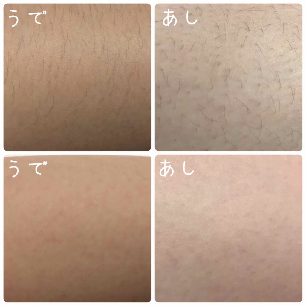 除毛クリームキット(トリートメントEX配合)/エピラット/除毛クリームを使ったクチコミ(3枚目)