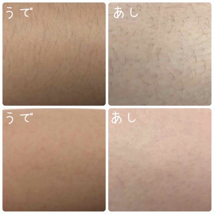 除毛クリームキット(トリートメントEX配合)/エピラット/除毛クリームを使ったクチコミ(3枚目)