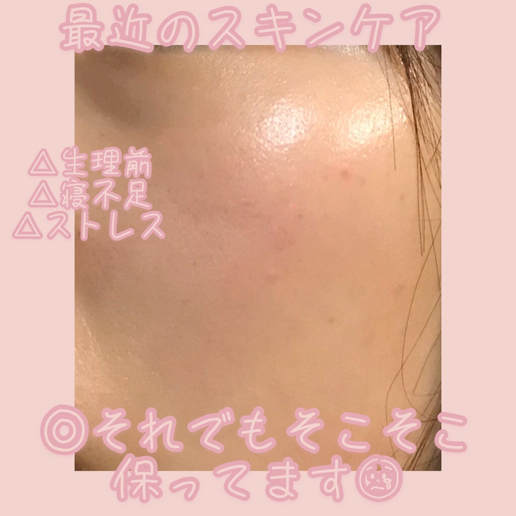 モイストバランス ジェル/ACSEINE/美容液を使ったクチコミ(1枚目)