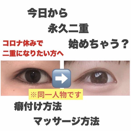 アイテープ(絆創膏タイプ、レギュラー、70枚)/DAISO/二重まぶた用アイテムを使ったクチコミ(1枚目)