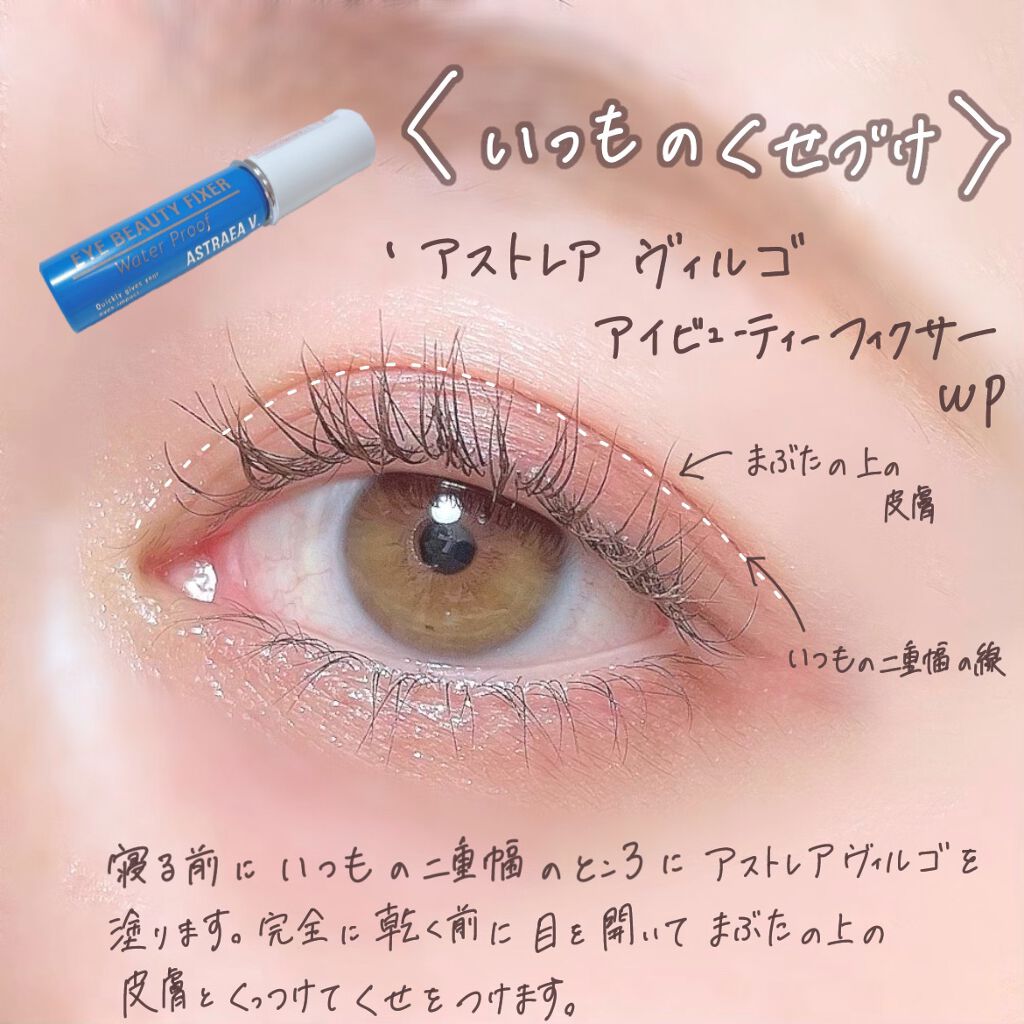 tobibi on LIPS 「2年半で目元はここまで垢抜けられる!/私の二重幅の広げ方とくせ..」(5枚目)