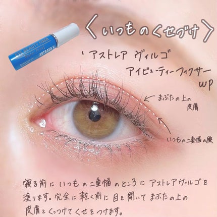 tobibi on LIPS 「2年半で目元はここまで垢抜けられる!/私の二重幅の広げ方とくせ..」(5枚目)