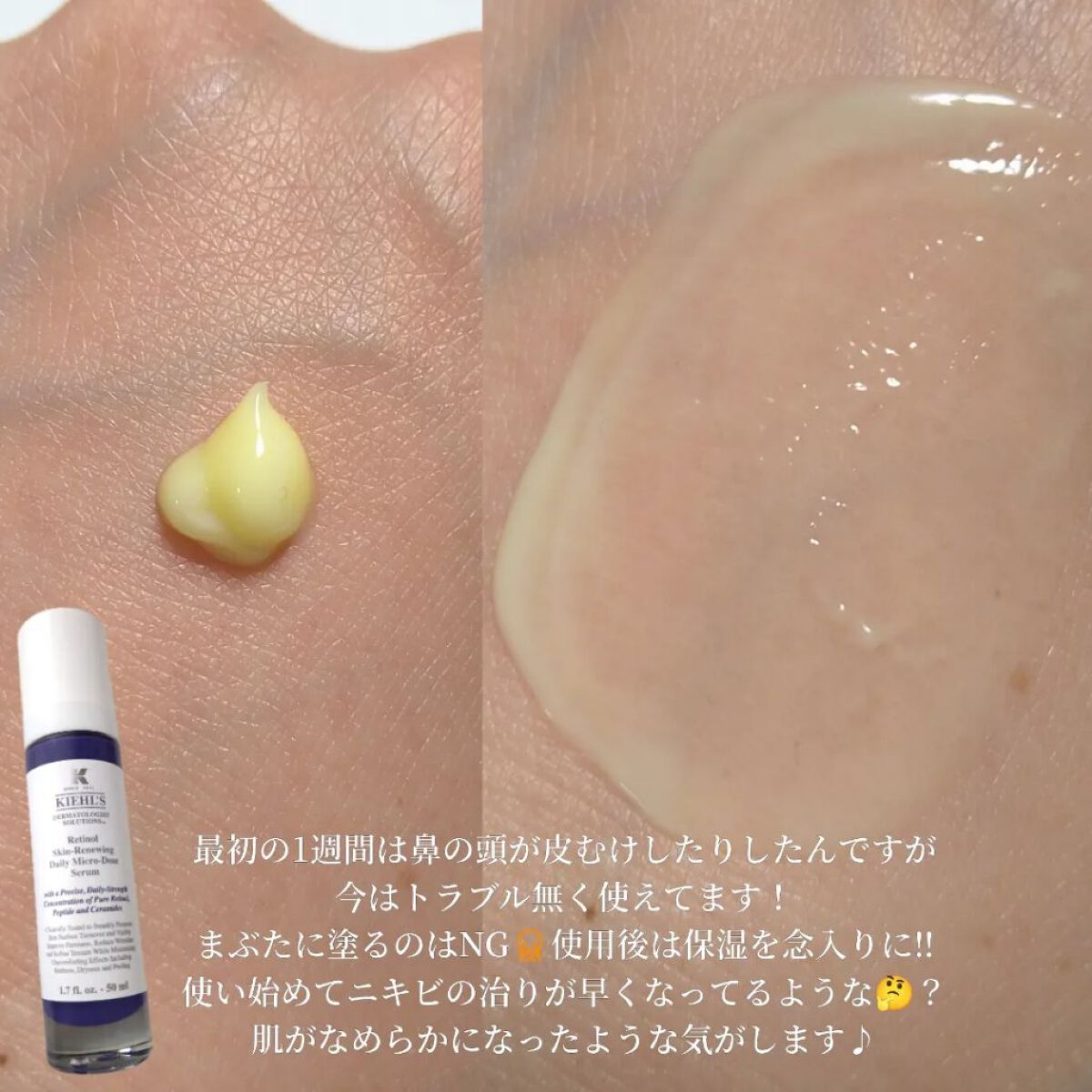 DS RTN リニューイング セラム/Kiehl's/美容液を使ったクチコミ（2枚目）