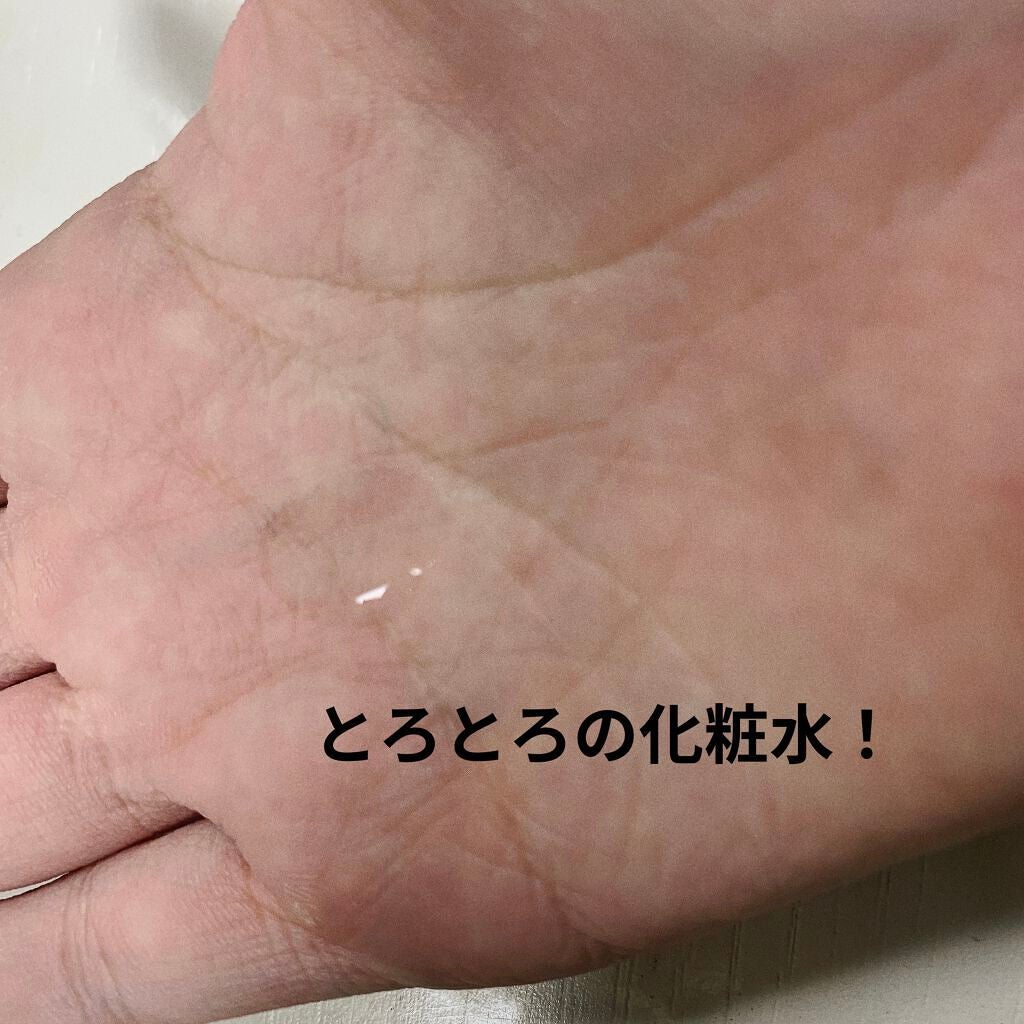 ハトムギ化粧水(ナチュリエ スキンコンディショナー R )/ナチュリエ/化粧水を使ったクチコミ(3枚目)