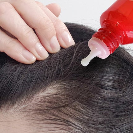 薬用 RJ地肌ケア エッセンス /アピセラピーコスメティクス/頭皮ローションを使ったクチコミ(4枚目)