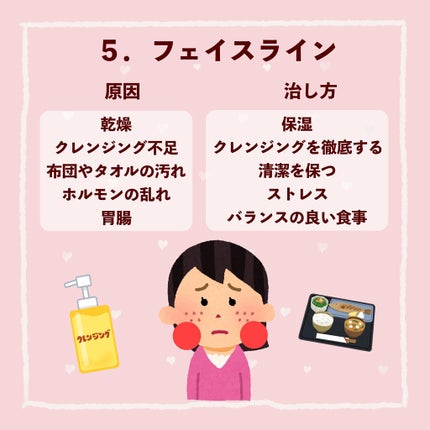 ペアアクネクリームW(医薬品)/ペア/その他を使ったクチコミ(6枚目)