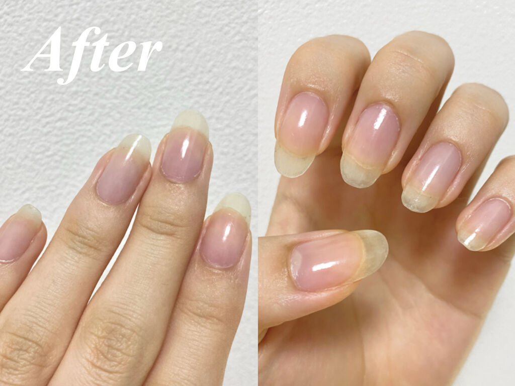 アボプレックス オイル/O・P・I/ネイルオイル・トリートメントを使ったクチコミ（3枚目）