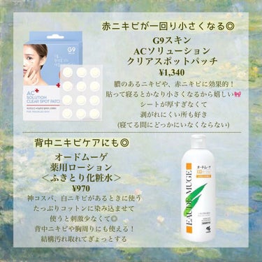 オードムーゲ オードムーゲ 薬用ローション（ふきとり化粧水）のクチコミ「ニキビや肌荒れにおすすめのアイテム&きをつけるべきこと等をまとめてみました🌿
﻿
私自身小.....」（3枚目）