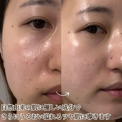 ラディアンスフィットセラムファンデーション/TFIT/リキッドファンデーションを使ったクチコミ(3枚目)