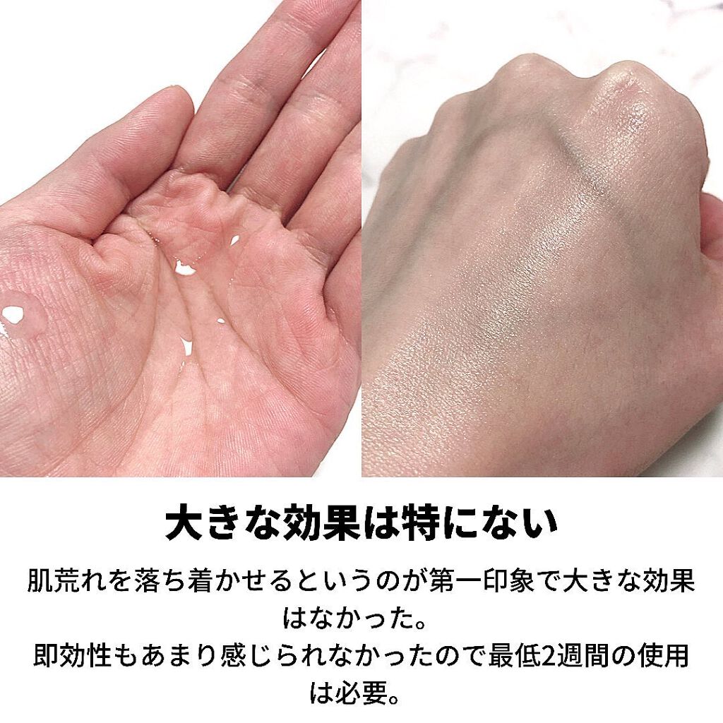 ピンクティーツリートナー/APLIN/化粧水を使ったクチコミ(4枚目)