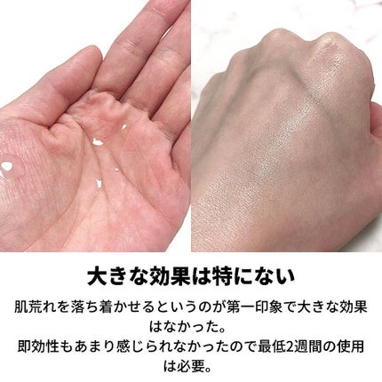 ピンクティーツリートナー/APLIN/化粧水を使ったクチコミ(4枚目)